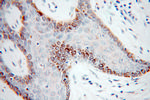 CSDE1 Antibody in Immunohistochemistry (Paraffin) (IHC (P))