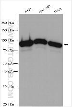 CSDE1 Antibody in Western Blot (WB)