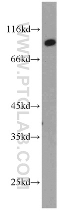 CSDE1 Antibody in Western Blot (WB)
