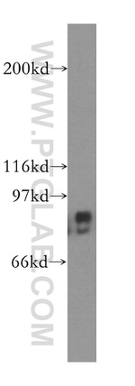CSDE1 Antibody in Western Blot (WB)