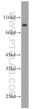 CSDE1 Antibody in Western Blot (WB)