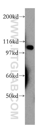 VPS54 Antibody in Western Blot (WB)