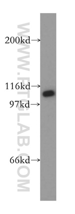 VPS54 Antibody in Western Blot (WB)