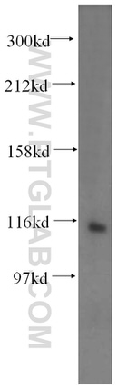 VPS54 Antibody in Western Blot (WB)