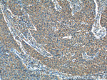 ADA Antibody in Immunohistochemistry (Paraffin) (IHC (P))