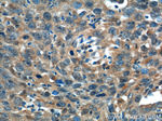 ADA Antibody in Immunohistochemistry (Paraffin) (IHC (P))