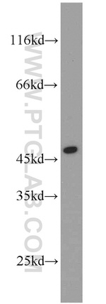 ADA Antibody in Western Blot (WB)