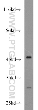 ADA Antibody in Western Blot (WB)