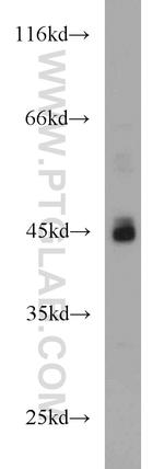 ADA Antibody in Western Blot (WB)