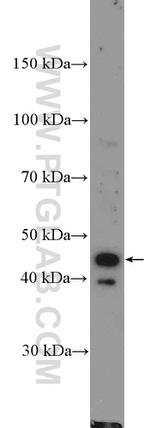 CD94 Antibody in Western Blot (WB)