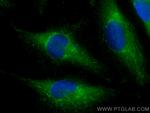 PPP3CB Antibody in Immunocytochemistry (ICC/IF)