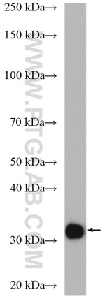 CA5B Antibody in Western Blot (WB)