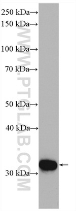 CA5B Antibody in Western Blot (WB)