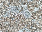 CA5B Antibody in Immunohistochemistry (Paraffin) (IHC (P))