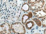 CA5B Antibody in Immunohistochemistry (Paraffin) (IHC (P))