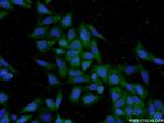 TPSAB1 Antibody in Immunocytochemistry (ICC/IF)