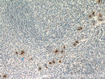 TPSAB1 Antibody in Immunohistochemistry (Paraffin) (IHC (P))