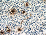 TPSAB1 Antibody in Immunohistochemistry (Paraffin) (IHC (P))
