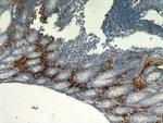 TPSAB1 Antibody in Immunohistochemistry (Paraffin) (IHC (P))