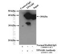 TPSAB1 Antibody in Immunoprecipitation (IP)