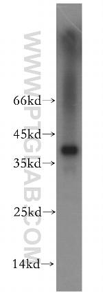 TPSAB1 Antibody in Western Blot (WB)