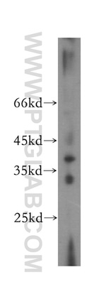 TPSAB1 Antibody in Western Blot (WB)