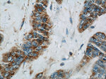 PLA2G4D Antibody in Immunohistochemistry (Paraffin) (IHC (P))