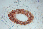 PLA2G4D Antibody in Immunohistochemistry (Paraffin) (IHC (P))