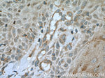PLA2G4D Antibody in Immunohistochemistry (Paraffin) (IHC (P))