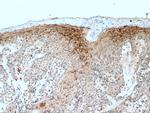 PLA2G4D Antibody in Immunohistochemistry (Paraffin) (IHC (P))