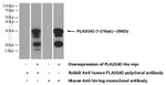 PLA2G4D Antibody in Western Blot (WB)