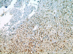 MCM6 Antibody in Immunohistochemistry (Paraffin) (IHC (P))