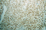 FBLIM1 Antibody in Immunohistochemistry (Paraffin) (IHC (P))