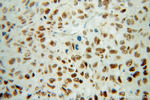 FBLIM1 Antibody in Immunohistochemistry (Paraffin) (IHC (P))