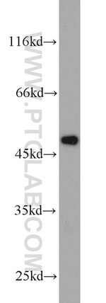 FBLIM1 Antibody in Western Blot (WB)