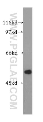 FBLIM1 Antibody in Western Blot (WB)