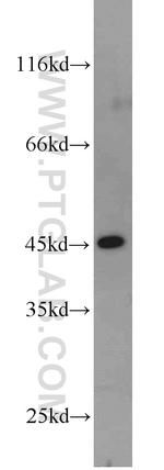 FBLIM1 Antibody in Western Blot (WB)