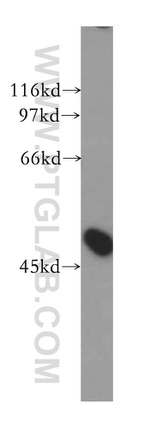 FBLIM1 Antibody in Western Blot (WB)