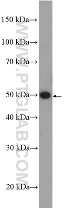 FBLIM1 Antibody in Western Blot (WB)