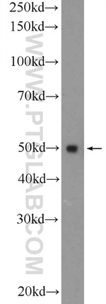 FBLIM1 Antibody in Western Blot (WB)