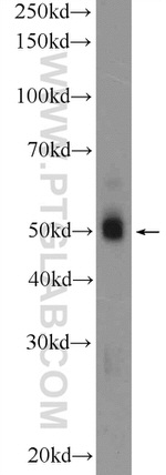 FBLIM1 Antibody in Western Blot (WB)