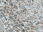 RAB39 Antibody in Immunohistochemistry (Paraffin) (IHC (P))