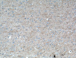 RAB39 Antibody in Immunohistochemistry (Paraffin) (IHC (P))