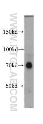 IL10RA Antibody in Western Blot (WB)