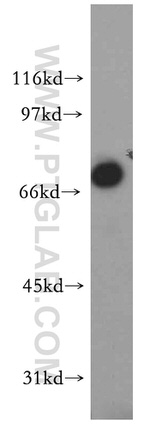 IL10RA Antibody in Western Blot (WB)