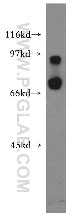 IL10RA Antibody in Western Blot (WB)
