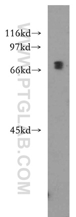 IL10RA Antibody in Western Blot (WB)