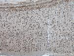 TDRD3 Antibody in Immunohistochemistry (Paraffin) (IHC (P))