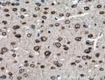 TDRD3 Antibody in Immunohistochemistry (Paraffin) (IHC (P))