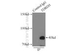 TDRD3 Antibody in Immunoprecipitation (IP)